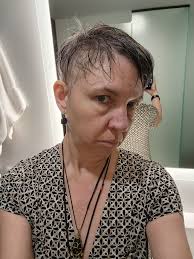 Hair loss concerns and eyebrow/eyelash anxiety