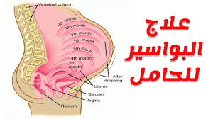 اسباب البواسير اثناء الحمل وطرق علاجها منزليا youtube