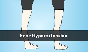 Fixing Hyperextended Knee Posture Somastruct Knee Exercises Hyperextended Knee Exercise
