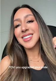 Transforming Taylor Paul's Smile: The Power of Small Changes