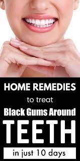 Oral Care Health Issues Home Remedies In 2021 Black Gums Oral Care Best Oral