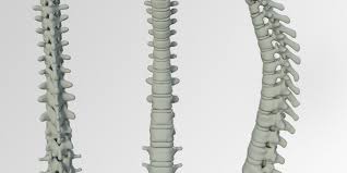• sakit belakang yg menyucuk : Slipped Disc Yang Masih Ramai Belum Tahu Info Physiomobile