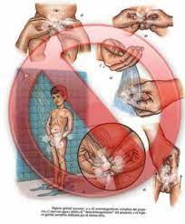Prepucio Mamas De Varones Club De Bebes Septiembre 2017 Babycenter
