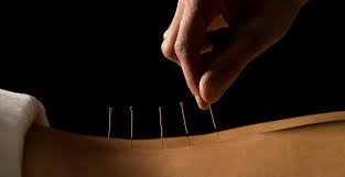 Does blue cross blue shield massachusetts cover acupuncture. New England Acupuncture Herbal Center Home Facebook
