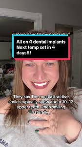 When Teeth Look Upper