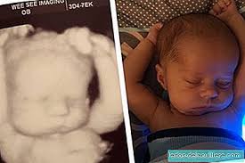 Gambar Lucu Bayi Tidur Dalam Kedudukan Yang Sama Seperti Yang Dilakukannya Di Dalam Rahim Bayi Baru Lahir