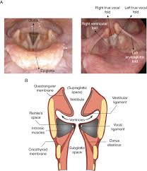 Image result for Functional Aphonia