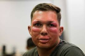 72 Michael Washburn Image: PICRYL