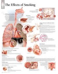 Effects Of Smoking Educational Chart Poster