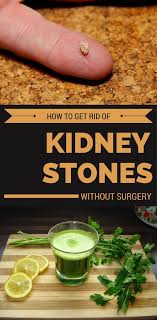 How To Get Rid Of Kidney Stones Without Surgery Beautyhealther Org Natural Headache Remedies Headache Remedies Kidney Stones Remedy