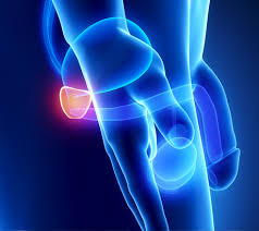 Image result for Prostate Cancer