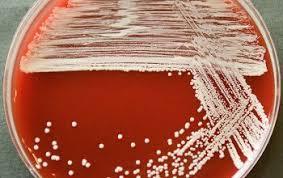 Image result for Staphylococcus Saprophyticus