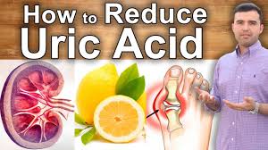 Uric acid is caused by the breakdown of the chemical purine, which is always present in the body and in some foods. How To Lower Uric Acid And Heal Gout What To Eat Home Remedies And Supplements Youtube