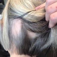 Usually, the bald patches appear suddenly and affect only a limited area. Clients With Thinning Hair Loss Read This Behindthechair Com