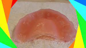 This is really easy and really does save money! Diy Professional Denture Reline Using Densurefit Youtube
