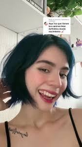 Corrección de Caninos Ectópicos en Ortodoncia