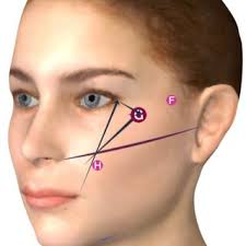 PDF) Esthetic considerations for treating the patient of European descent:  Thriving in diversity international roundtable series