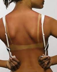 Foods That Will Increase Melanin Production Tratamientos De Belleza Salud Y Belleza Cabello Y Belleza