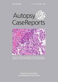 Autopsy Case Report By Editora Cubo Issuu