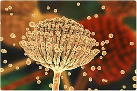 L'aspergillose est aussi une maladie infectieuse. Causes D Aspergillose