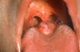 Maybe you would like to learn more about one of these? Tongue Anatomy Flashcards Quizlet