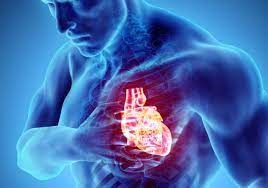 We did not find results for: Infarct Miocardic Divahair Ro