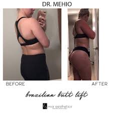 It's part of a large conglomerate that also owns keurig and dozens of other brands. Mia Aesthetics What A Beautiful Transformation By Drmehio Mia Bbl Brazilianbuttlift Before After Beforeandafter Amazing Beautiful Results Summerbody Summerready Surgery Plasticsurgery Surgerypostop Surgeon Plasticsurgeon