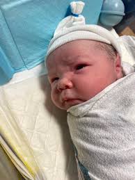 Up date below. Im doing great! Post surgery 7 days. I haven't even hardly  been able to think about my hip. On day 5 went to first rehab and had a  pulmonary