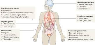 These images give an impression on the quality and functionality of the model. Mechanisms And Treatment Of Organ Failure In Sepsis Nature Reviews Nephrology