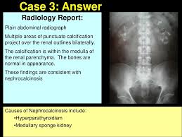 Upper gi series or barium swallow: Ppt The Abdominal X Ray Powerpoint Presentation Free Download Id 23266
