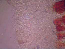 Image result for didymascella thujina