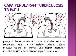 Faktanya, banyak keyboard yang memiliki jenis tersendiri untuk jenis keyboard yang sangat umum digunakan, mungkin termasuk juga toppers. Tuberculosis Tb Paru Ppt Download