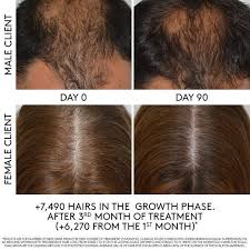 Thinning Hair Women Thinninghairwomen Thin Hair Styles For Women Hairstyles For Thin Hair Womens Hairstyles