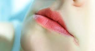 заеды в уголках рта причины и лечение у взрослых Zaedy V Ugolkah Rta Angulit Prichiny Lechenie V Domashnih Usloviyah 24smi