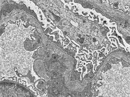 Loss of appetite, fatigue, and. Genetic Diseases