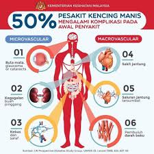 Maybe you would like to learn more about one of these? Tips For A Healthy Life Bahayanya Kencing Manis