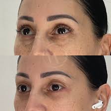 Vado Plastic Surgery added a new photo.