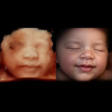 Image result for tbn:T5UajvfpShvp6M::www.photoslinks.com/index.php%3Foption%3Dcom_joomgallery%26func%3Dwatermark%26catid%3D4%26id%3D23%26Itemid%3D2