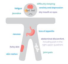 Image result for hepatitis symptoms
