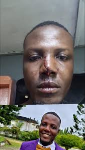 Update! I am getting information that members of the CDC beat this guy just  because he has been promoting the government of Liberia. Did Hon Mark Kulah  stop you from showcasing or