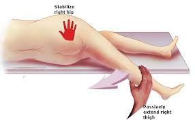 Image result for Psoas Sign