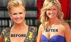 The tv host, who was with access hollywood at the time, said trump's . Pin On Celeblens Celebrity Plastic Surgery Before And After Photos
