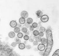 Hantavirus infections definition hantavirus infection is caused by a group of viruses that can infect humans with two serious illnesses: Hantavirus Microbewiki