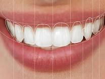Smile Design in Wagholi, Pune product image