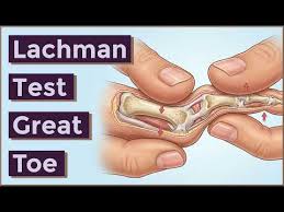Image result for Lachman Test