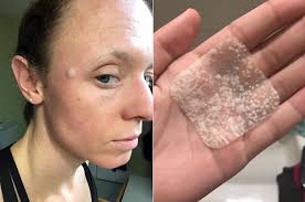 But, just like any other category in skincare, there's an excess of product launches, making it hard to pinpoint which ones you need to stick on your face. 27 Things That Ll Get Rid Of Pimples As Fast As Possible How To Get Rid Of Pimples Pimples Acne Spot Treatment