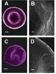 Red blood cells larger than 100 fl are considered macrocytic. A Red Blood Cell From A Healthy Individual Scale 1 Lm B Red Download Scientific Diagram