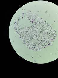 Listeria innocua is one of the six species belonging to the genus listeria. Listeria Innocua Gram Positive 1000x Oil Immersion Flickr