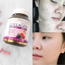 Colla rich collagen 60 kapsulrp67.000: Jual Colla Rich Collagen Ori Thailand Atau Suplemen Pemutih Kulit Super Di Lapak Ailin Kosmetik Jkt Bukalapak