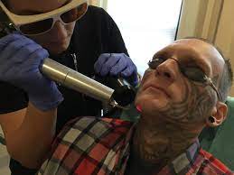 Check spelling or type a new query. Tattoo Removal Programs Help Former Inmates Wipe The Slate Clean Npr